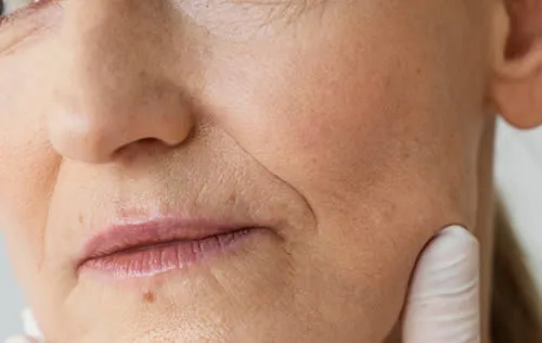 age-spots hands-with-gloves-holding-woman-s-face
